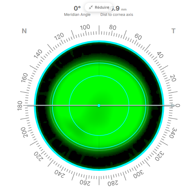 Simulated fluorescein pattern with lens zone rings and a degree scale